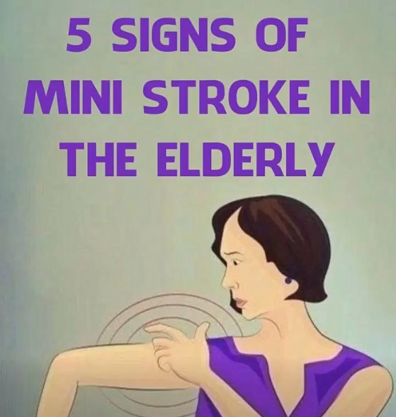 When Subtle Changes in Aging Could Signal a Mini-Stroke — Key Warning Signs to Watch For