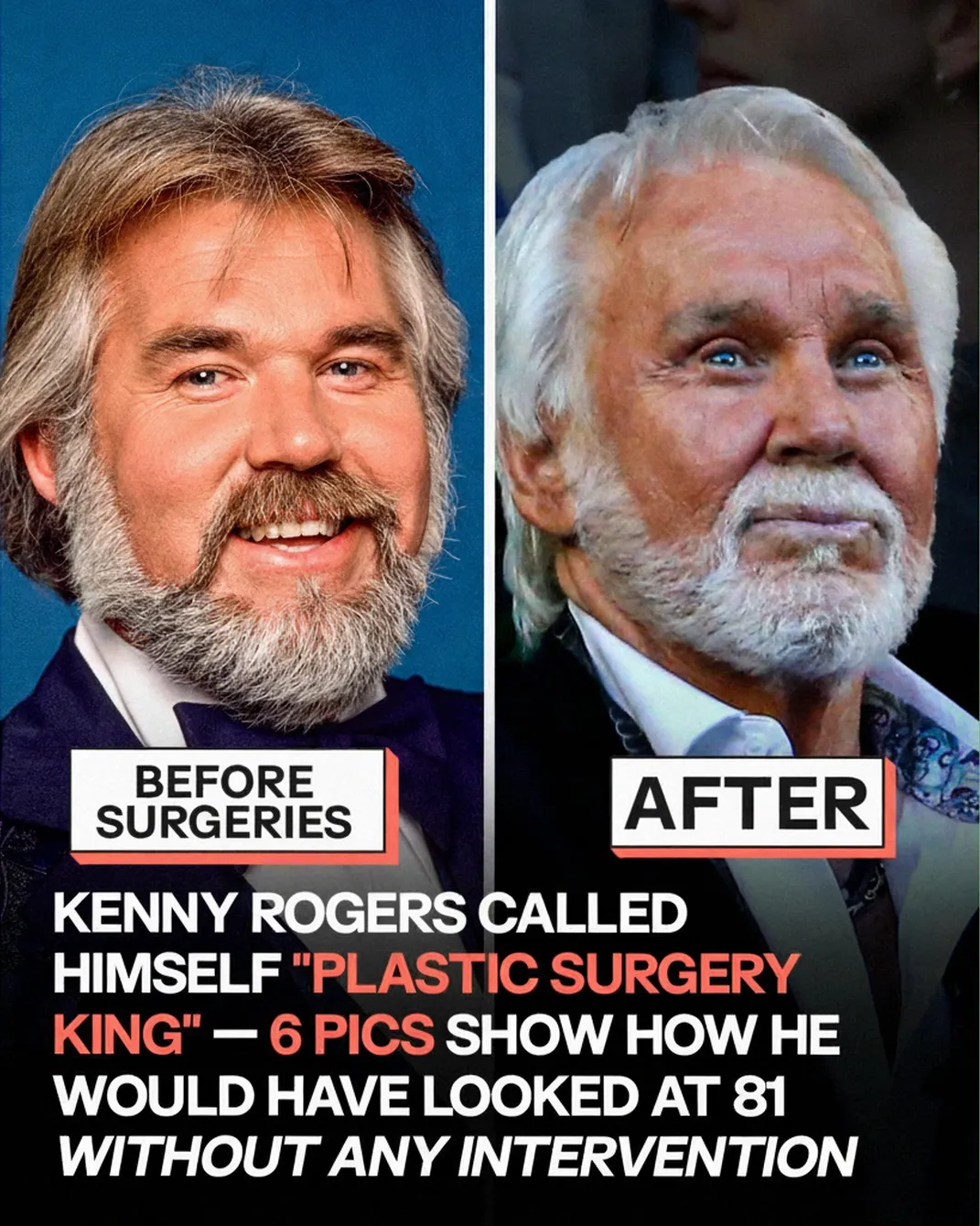 Kenny Rogers Through the Years: An Inspiring Look at His Journey and Legacy