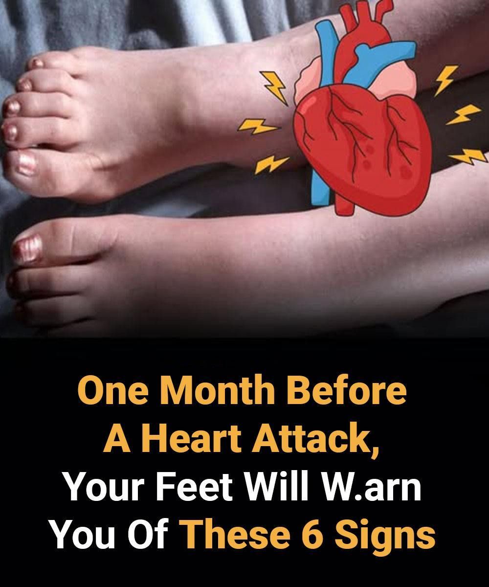 6 Subtle Foot Signs That May Indicate Early Heart Concerns