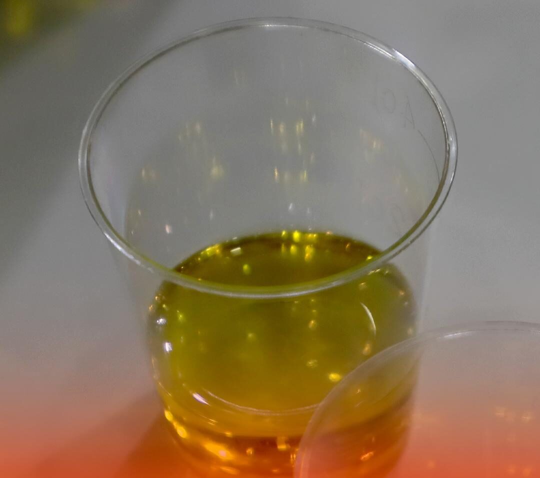 She Drank a Spoonful of Olive Oil Every Day for a Week — The Results Were Truly Surprising