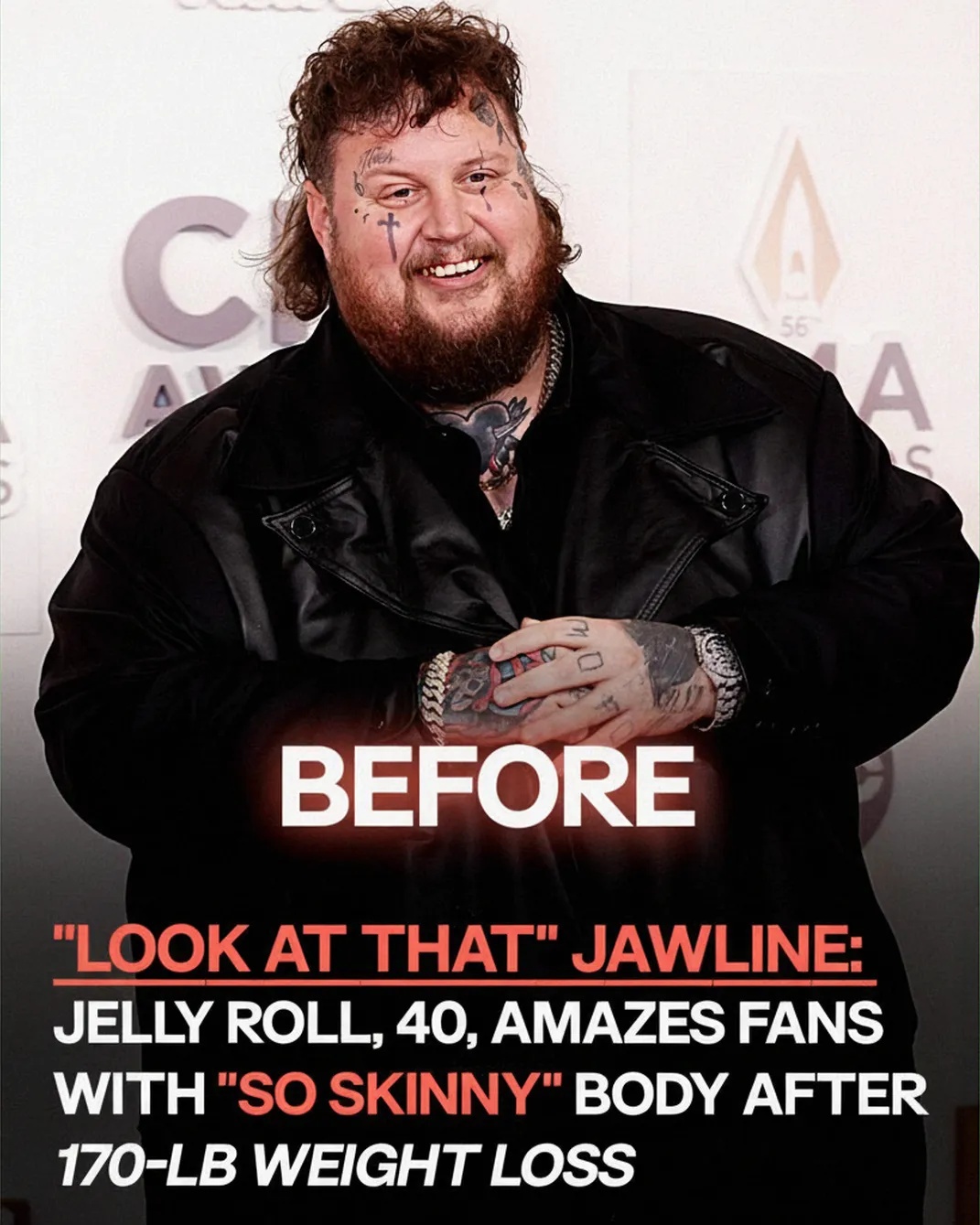 Jelly Roll, 40, Impresses Fans With His Slim Look After Losing Nearly 200 Pounds