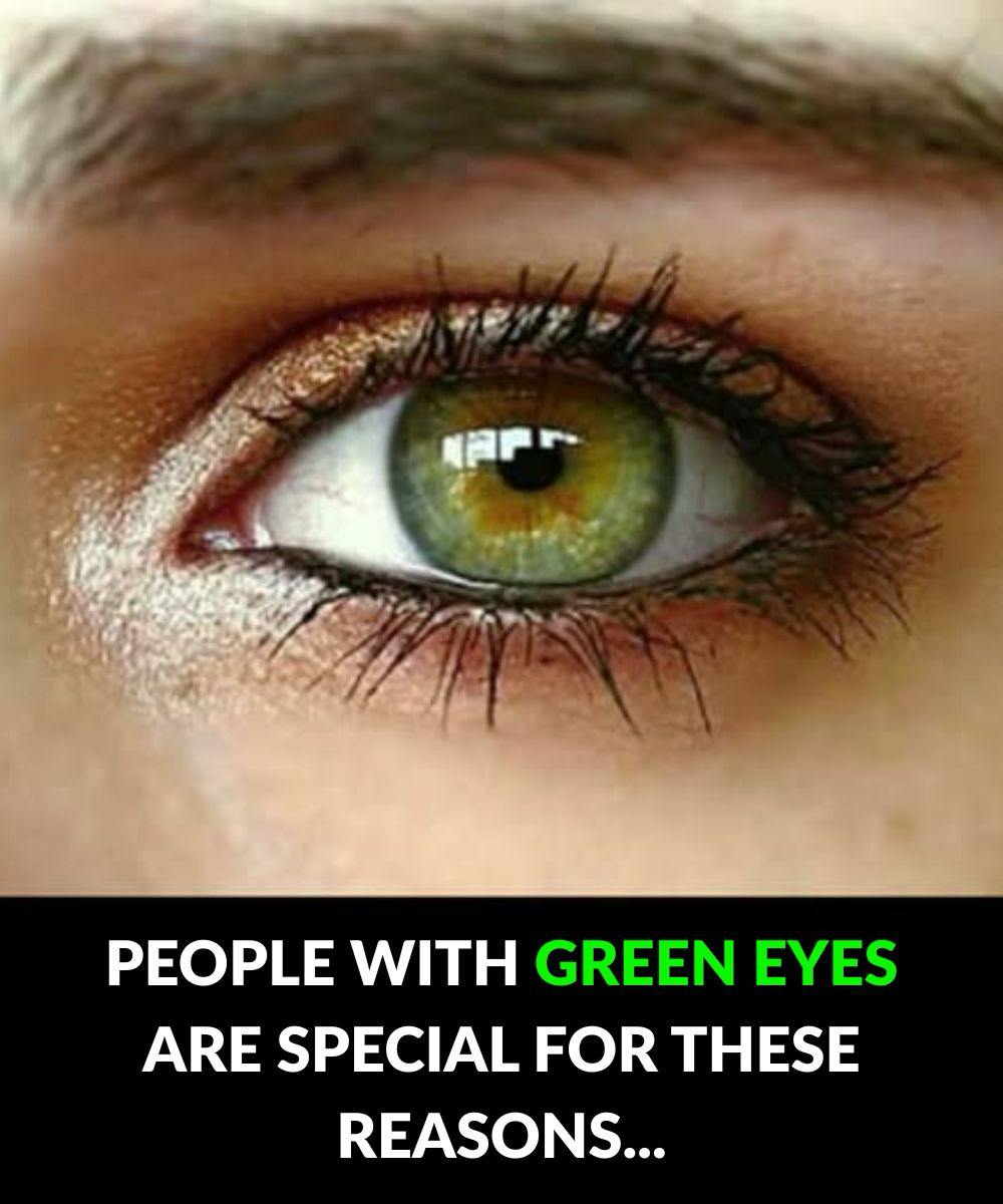 Why Green Eyes Are Unique: Science, Care, and Cultural Significance