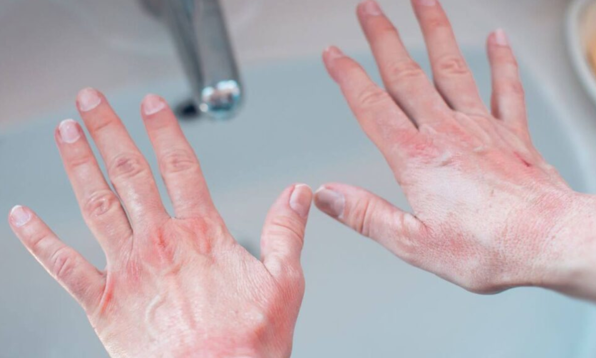 What Sleeping in a Very Cold Environment Can Do to Your Body