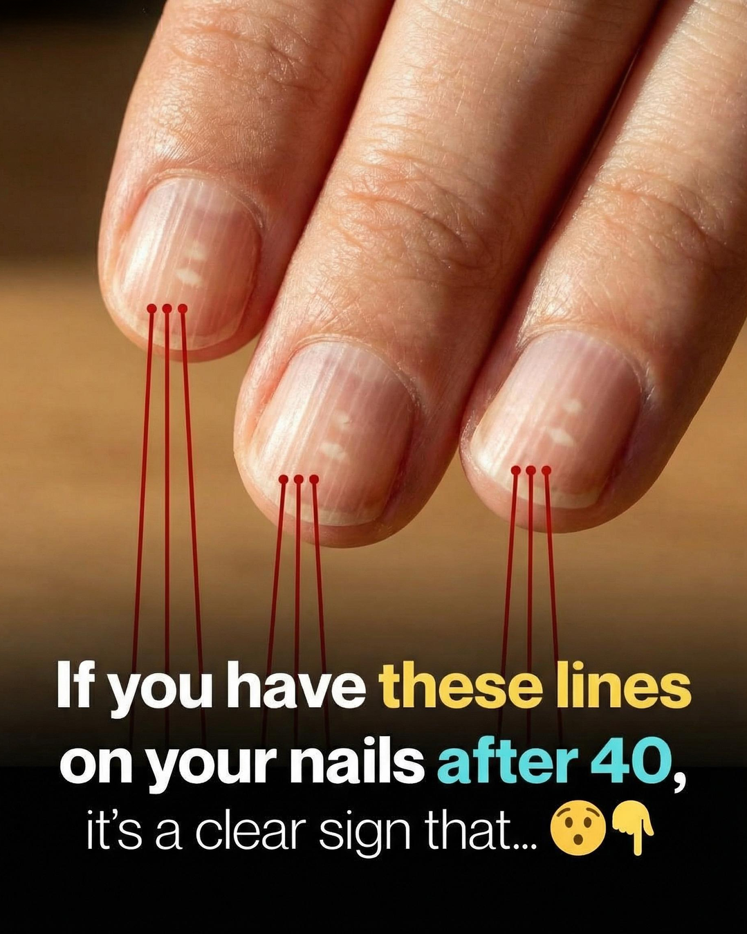 Why Vertical Lines Commonly Appear on Fingernails as You Get Older