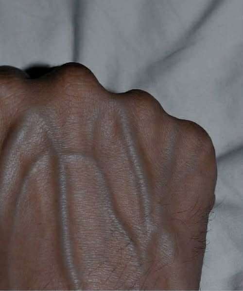 What Visible Veins May Indicate About Your Body and Skin Type