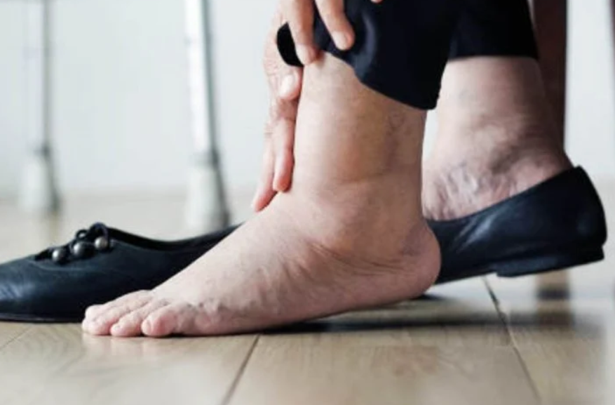 Common Reasons for Skin Changes on the Legs and Helpful Skin Care Tips