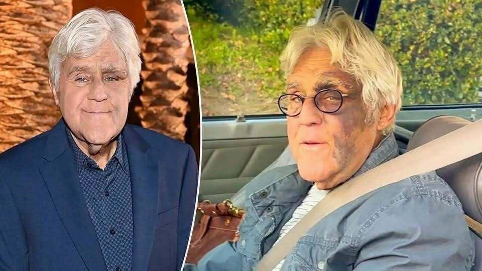 Jay Leno’s Passion for Classic Cars Continues to Define His Legacy