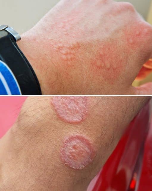 Groin Irritation? Here’s Why It May Be Worth Paying Attention To