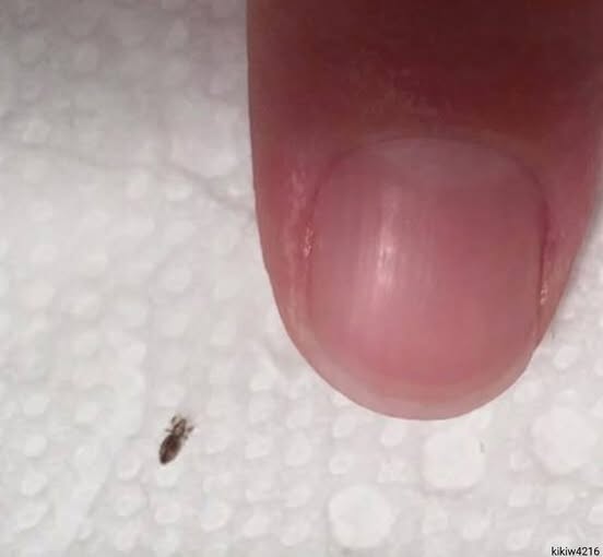 If you find this bug in your hair. How to get rid of them and stop them coming back