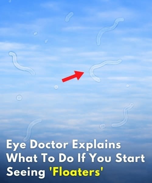 Understanding Eye Floaters and Flashes: When It’s Important to Seek Professional Evaluation