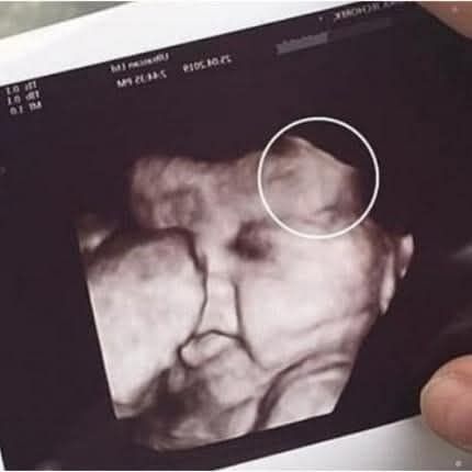 Doctors couldn’t believe what they saw during the ultrasound