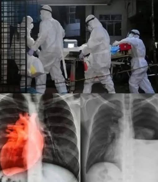 Scientists Discover What May Be Causing Certain Cases of Heart Inflammation