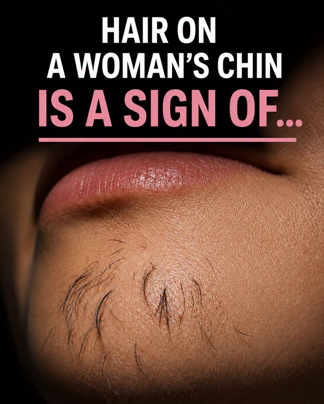 Why Some Women Develop Chin Hair and What It Can Sometimes Indicate