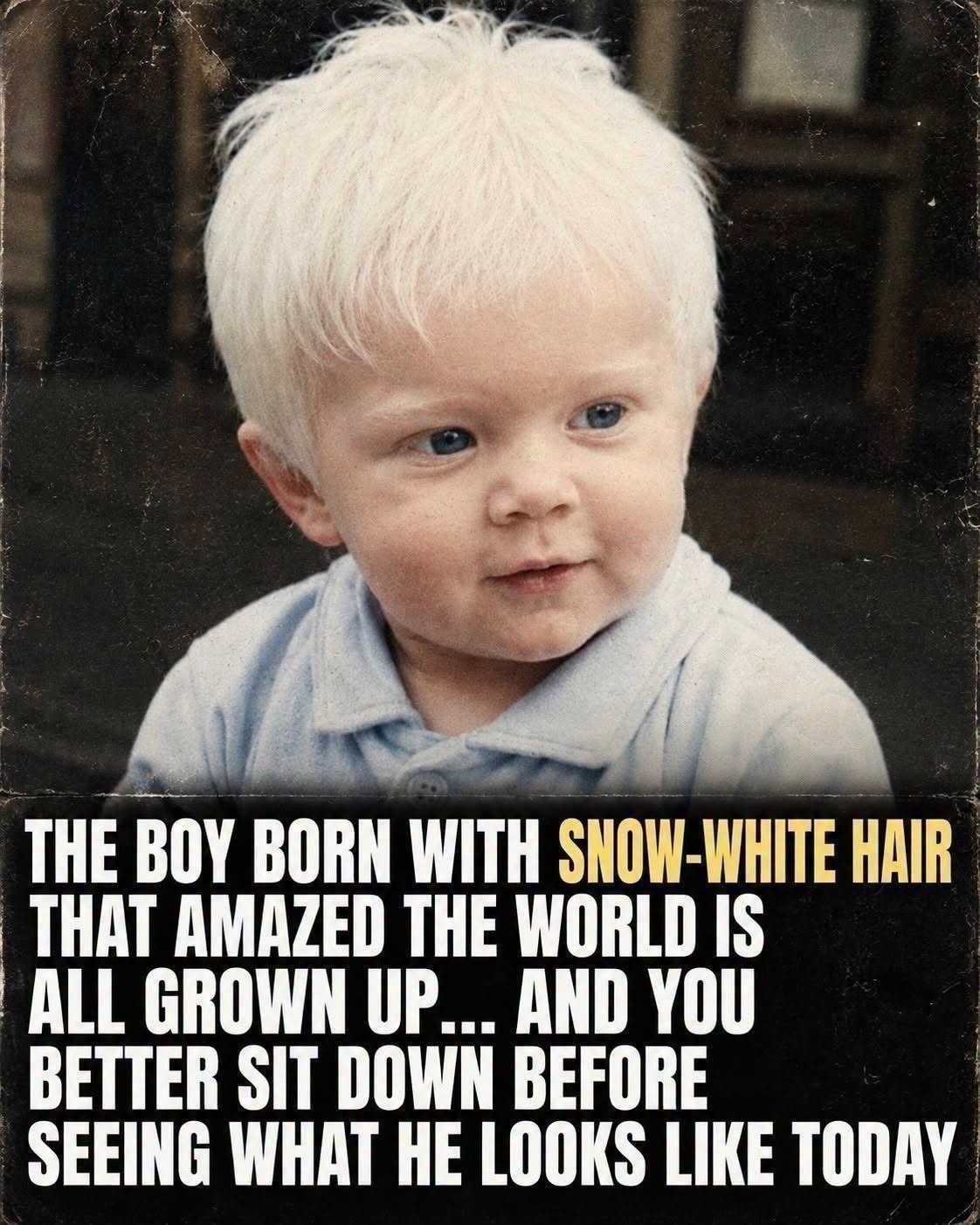 The Boy With Snow-White Hair Who Captivated the World—Where Is He Today?