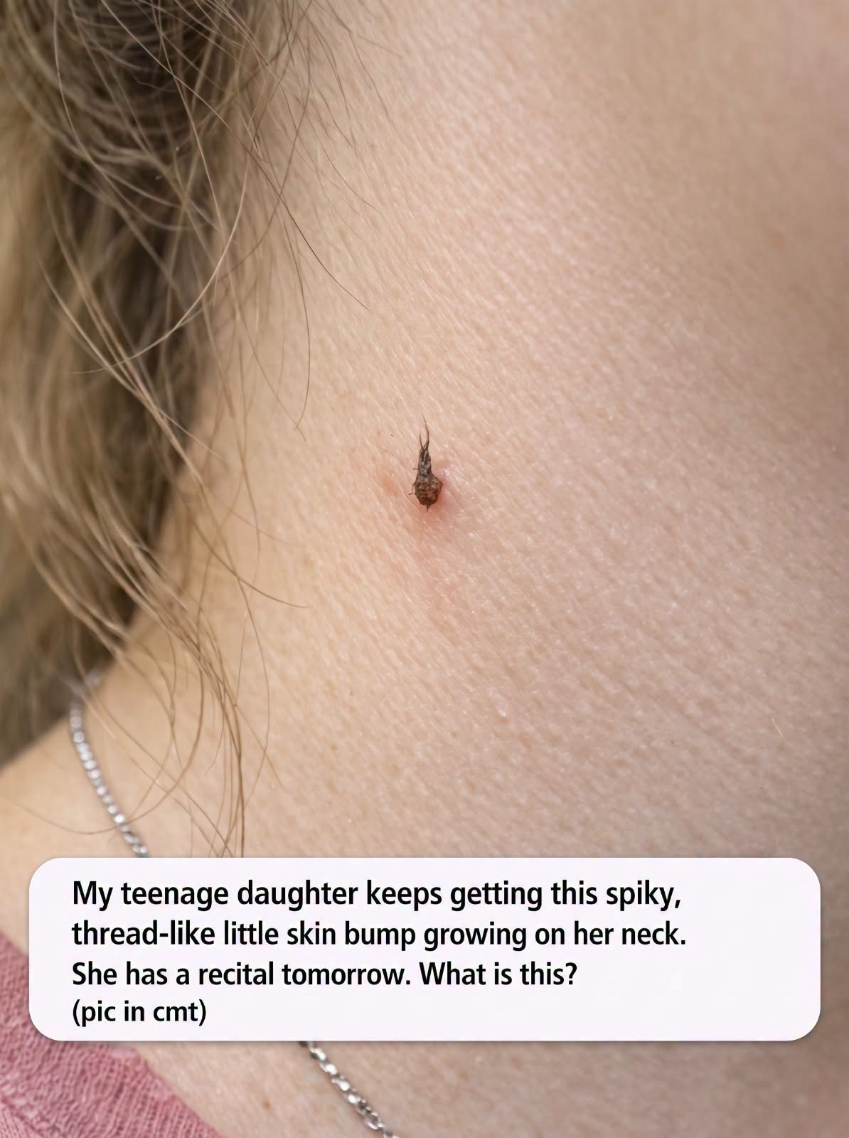 Small Fingerlike Growth on the Neck: Possible Causes and When to Seek Medical Advice
