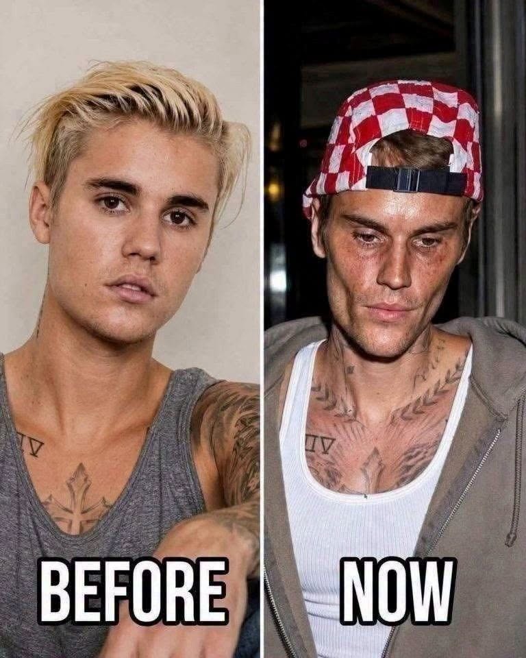 Justin Bieber’s Journey From Young Music Sensation to Personal Growth and Health Awareness