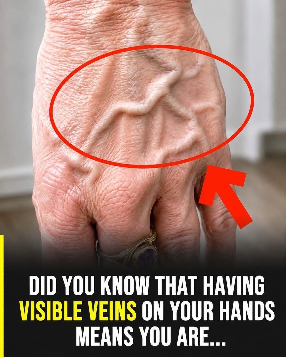 Visible Veins on Your Hands and Legs: Common Causes and When to Seek Medical Advice